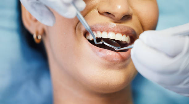 Best Emergency Dental Care for Broken or Chipped Teeth in Bray, OK